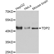 Western blot analysis of extracts of various cell lines, using TDP2 Antibody (abx126687) at 1:3000 dilution.