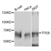 Western blot analysis of extracts of various cell lines, using TFEB antibody (abx126691) at 1/1000 dilution.