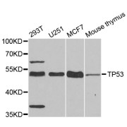 Western blot analysis of extracts of various cell lines, using TP53 antibody (abx126726) at 1/1000 dilution.