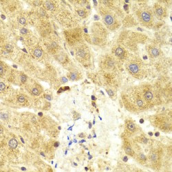 Cellular Tumor Antigen P53 (TP53) Antibody