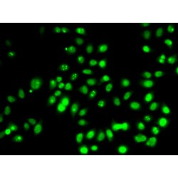 Cellular Tumor Antigen P53 (TP53) Antibody