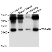 Western blot analysis of extracts of various cell lines, using TSPAN4 antibody (abx126745) at 1/1000 dilution.