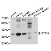 Western blot analysis of extracts of various cell lines, using TYMS antibody (abx126749) at 1/1000 dilution.