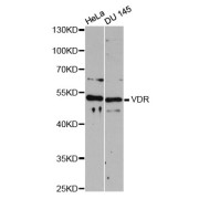 Western blot analysis of extracts of various cell lines, using VDR antibody (abx126773) at 1:3000 dilution.