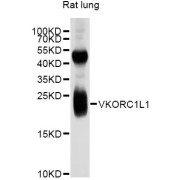 Western blot analysis of extracts of rat lung, using VKORC1L1 antibody (abx126786) at 1/1000 dilution.