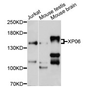 Western blot analysis of extracts of various cell lines, using XPO6 antibody (abx126798) at 1/1000 dilution.