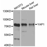 Western blot analysis of extracts of various cell lines, using YAP1 antibody (abx126802) at 1/1000 dilution.