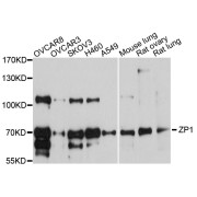 Western blot analysis of extracts of various cell lines, using ZP1 antibody (abx126810) at 1/1000 dilution.