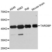 Western blot analysis of extracts of various cell lines, using TARDBP antibody (abx127061) at 1/1000 dilution.