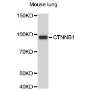 Western blot analysis of extracts of mouse lung, using CTNNB1 antibody (abx127105).