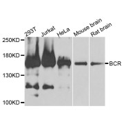 Western blot analysis of extracts of various cell lines, using BCR antibody (abx135697) at 1/1000 dilution.