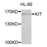 Western blot analysis of extracts of HL-60 cells, using KIT antibody (abx135700) at 1/1000 dilution.
