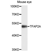 Western blot analysis of extracts of mouse eye, using TFAP2A antibody (abx135702) at 1/1000 dilution.