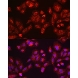 Galactosylceramidase (GALC) Antibody