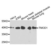 Western blot analysis of extracts of various cell lines, using TMOD1 antibody (abx135734) at 1/1000 dilution.