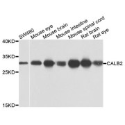 Western blot analysis of extracts of various cell lines, using CALB2 antibody (abx135751) at 1/1000 dilution.