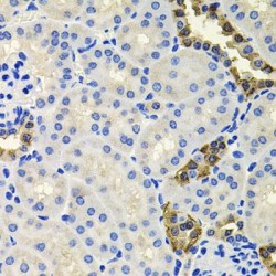 Calretinin (CALB2) Antibody