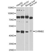 Western blot analysis of extracts of various cell lines, using CHRNB2 Antibody (abx135752) at 1/1000 dilution.