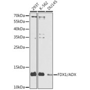 Western blot analysis of extracts of various cell lines using FDX1 antibody (1/1000 dilution).