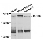 Western blot analysis of extracts of various cell lines, using JARID2 antibody (abx135767) at 1/1000 dilution.