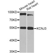 Western blot analysis of extracts of various cell lines, using KCNJ3 Antibody (abx135768) at 1/1000 dilution.