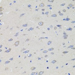 Potassium Inwardly Rectifying Channel Subfamily J, Member 3 (KCNJ3) Antibody