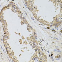 Potassium Inwardly Rectifying Channel Subfamily J, Member 3 (KCNJ3) Antibody