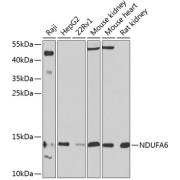 Western blot analysis of extracts of various cell lines using NDUFA6 antibody (1/1000 dilution).