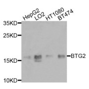 Western blot analysis of extracts of various cell lines, using BTG2 antibody (abx135792) at 1/1000 dilution.