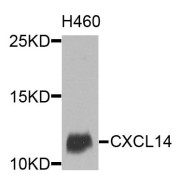 Western blot analysis of extracts of H460 cells, using CXCL14 antibody (abx135801) at 1/1000 dilution.