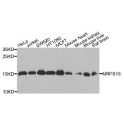 Western blot analysis of extracts of various cell lines, using MRPS16 antibody (abx135818) at 1/1000 dilution.