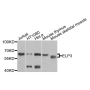 Western blot analysis of extracts of various cell lines, using ELP3 antibody (abx135821) at 1/1000 dilution.