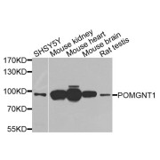 Western blot analysis of extracts of various cell lines, using POMGNT1 antibody (abx135823) at 1/1000 dilution.