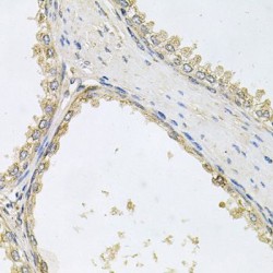 Protein O-Linked-Mannose Beta-1,2-N-Acetylglucosaminyltransferase 1 (POMGNT1) Antibody