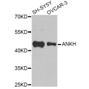 Western blot analysis of extracts of various cell lines, using ANKH Antibody (abx135825) at 1/1000 dilution.