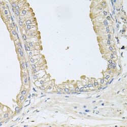 Progressive Ankylosis Protein Homolog (ANKH) Antibody