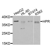 Western blot analysis of extracts of various cell lines, using HPR antibody (abx135842) at 1/1000 dilution.