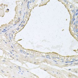 Haptoglobin Related Protein (HPR) Antibody