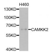 Western blot analysis of extracts of H460 cells, using CAMKK2 antibody (abx135843) at 1/1000 dilution.