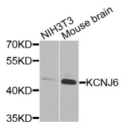 Western blot analysis of extracts of various cell lines, using KCNJ6 antibody (abx135855) at 1/1000 dilution.