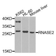 Western blot analysis of extracts of various cell lines, using RNASE2 antibody (abx135869) at 1/1000 dilution.