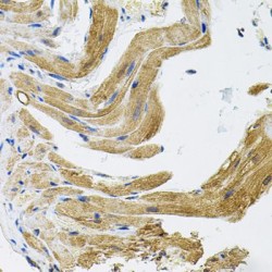 Transient Receptor Potential Cation Channel Subfamily C Member 1 (TRPC1) Antibody