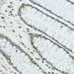 E3 Ubiquitin-Protein Ligase TRIP12 (TRIP12) Antibody