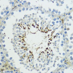 E3 Ubiquitin-Protein Ligase TRIP12 (TRIP12) Antibody