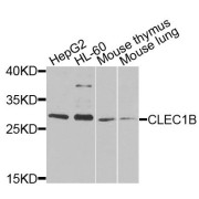 Western blot analysis of extracts of various cell lines, using CLEC1B antibody (abx135891) at 1/1000 dilution.