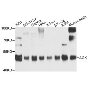 Western blot analysis of extracts of various cell lines, using AGK antibody (abx135896) at 1/1000 dilution.