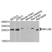 Western blot analysis of extracts of various cell lines, using MYL6B antibody (abx135916) at 1/1000 dilution.
