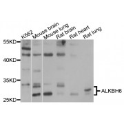 Western blot analysis of extracts of various cell lines, using ALKBH6 antibody (abx135923) at 1/1000 dilution.