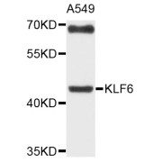 Western blot analysis of extracts of A-549 cells, using KLF6 antibody (abx135929) at 1/1000 dilution.