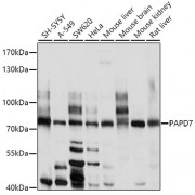 Western blot analysis of extracts of various cell lines, using TENT4A/PAPD7 antibody (1/1000 dilution).